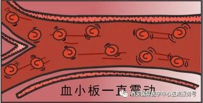 【科普】血小板是正常值的三倍？專家提醒小心血栓和出血！