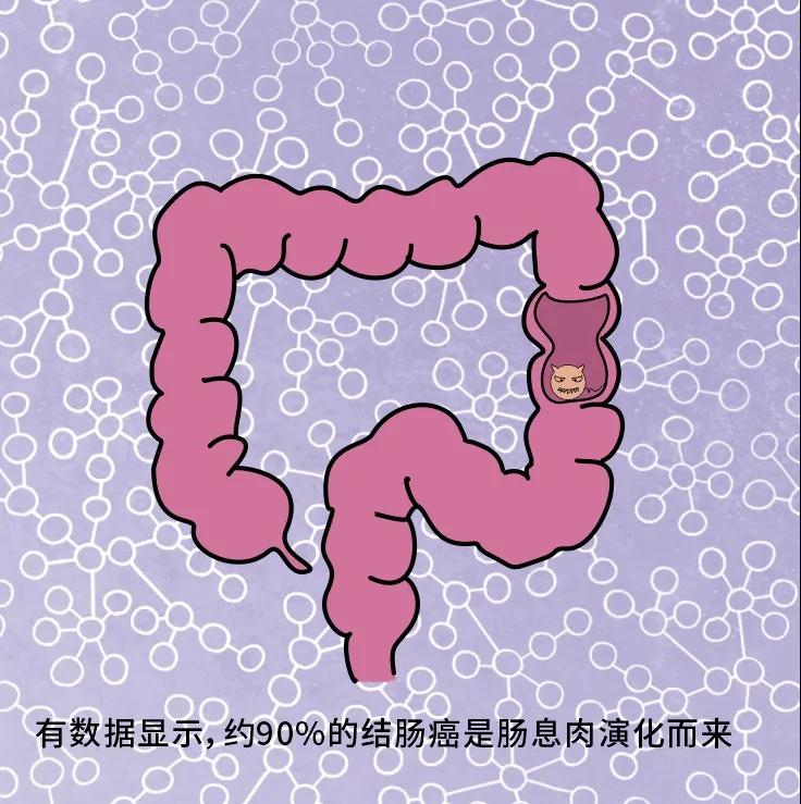 奪走“黑豹”生命的結(jié)腸癌，到底什么來頭？