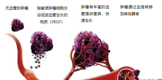 晚期腫瘤為什么會復發(fā)轉移？