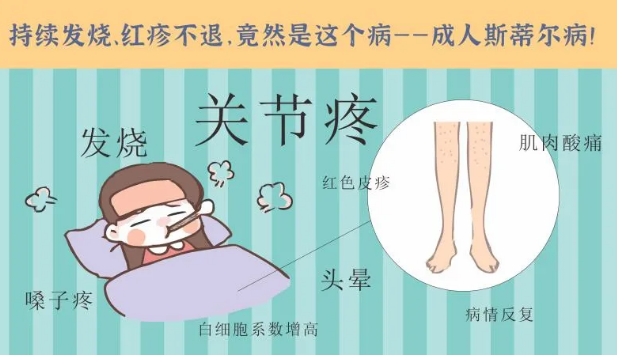 持續(xù)發(fā)燒、紅疹不退……她終于在這里治好了這個(gè)罕見(jiàn)病