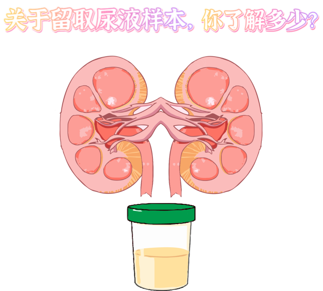 做尿檢，不得不說(shuō)的注意事項(xiàng)！