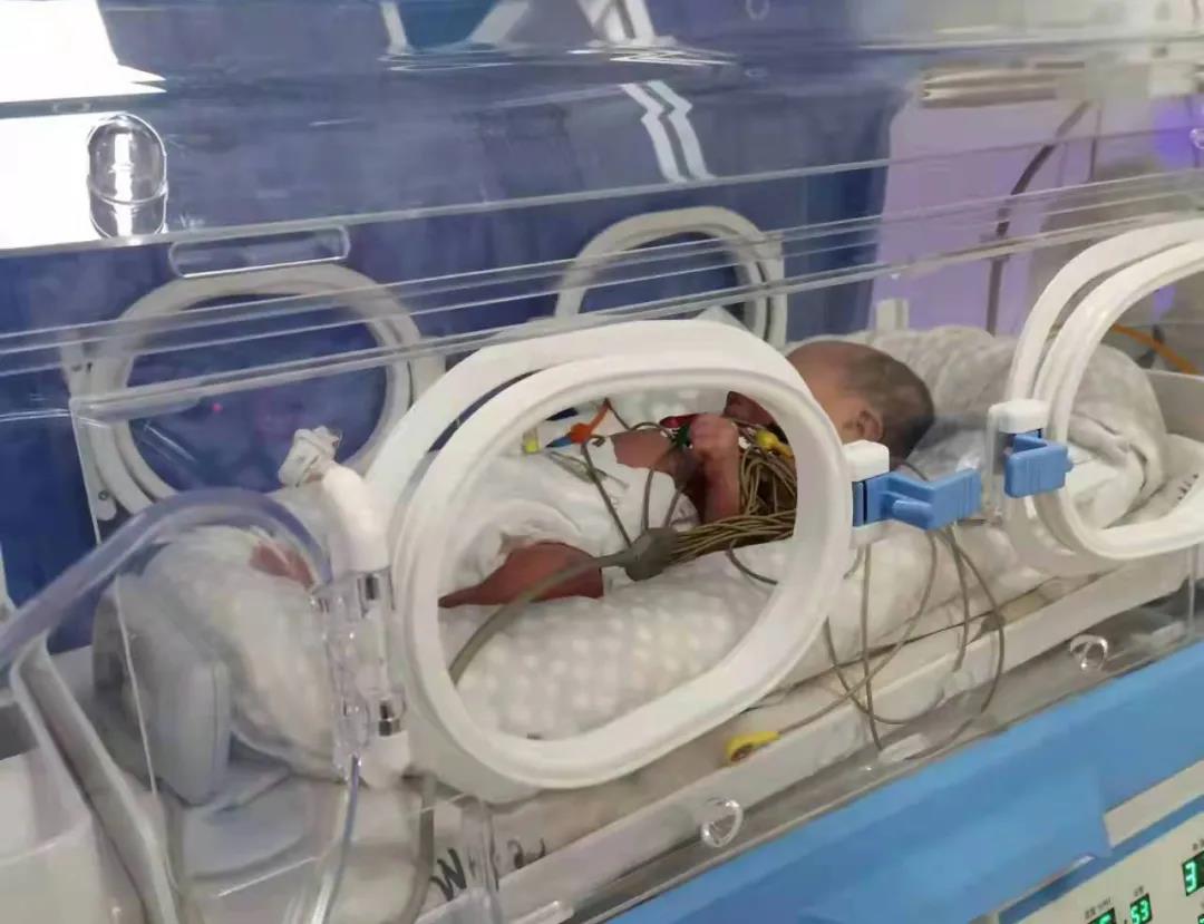 【科普】新生兒體質弱，心肌炎該如何確診？