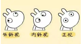 小baby老歪著頭？警惕斜頸! 這樣糾正……