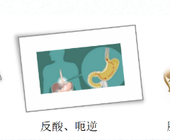 關(guān)愛身體健康，輕松檢查胃腸