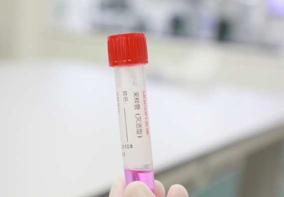 支原體感染檢測手段知多少？