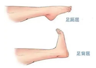 扭胯小連步、動(dòng)感搖花手……“科目三”雖火，運(yùn)動(dòng)損傷也要防！